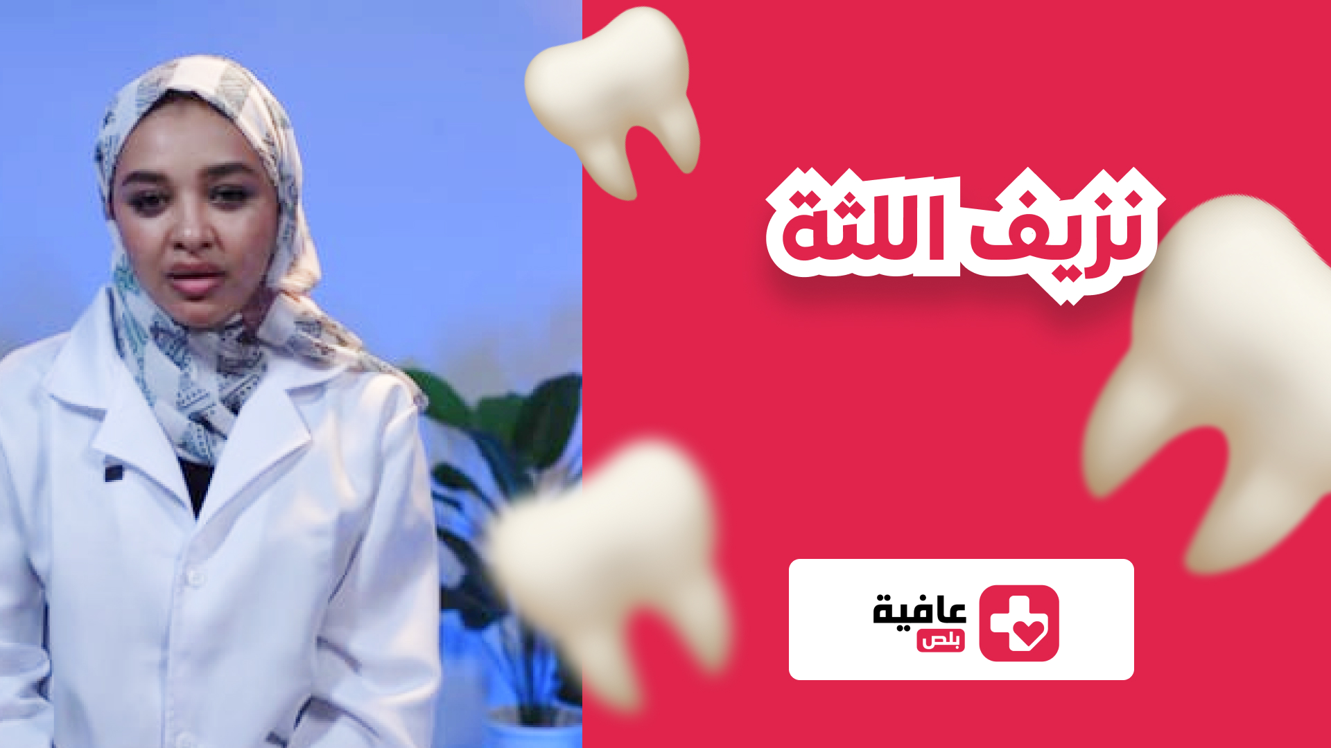 نزيف اللثة